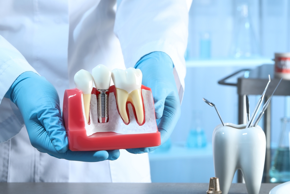 Dentist,Holding,Educational,Model,Of,Gum,With,Dental,Implant,Between