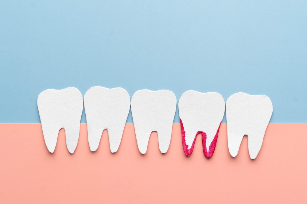 White,Teeth,Bleeding,Cartoon,Made,From,Paper.,Bleeding,Gums,Are