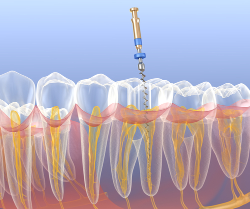 periodontal services